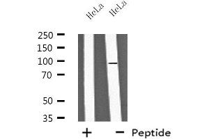 Western blot analysis of extracts from HeLa cells, using PA2G6 antibody. (PLA2G6 Antikörper  (Internal Region))