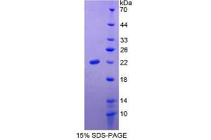 SDS-PAGE analysis of Human Slit Homolog 3 Protein. (SLIT3 Protein)