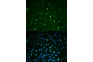 Immunofluorescence analysis of U2OS cells using Phospho-H2AFX-S139 antibody (ABIN5969940). (H2AFX Antikörper  (pSer139))