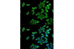 Immunofluorescence analysis of U2OS cells using HTR2B antibody (ABIN6127310, ABIN6142069, ABIN6142070 and ABIN6221320). (Serotonin Receptor 2B Antikörper  (AA 382-481))