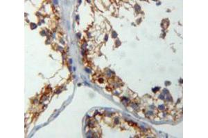 IHC-P analysis of testis tissue, with DAB staining. (CRAT Antikörper  (AA 1-430))