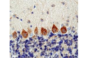Immunohistochemistry (IHC) image for anti-Vesicle Transport through Interaction with T-SNAREs Homolog 1B (VTI1B) (AA 1-206) antibody (ABIN1742350)