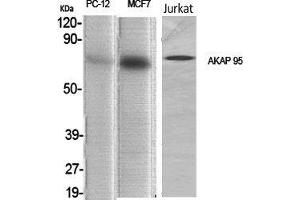 Western Blot (WB) analysis of specific cells using AKAP 95 Polyclonal Antibody. (AKAP8 Antikörper  (Internal Region))