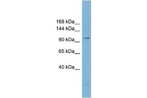 WB Suggested Anti-ACLY Antibody Titration:  0. (ACLY Antikörper  (Middle Region))