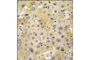 Immunohistochemistry (Paraffin-embedded Sections) (IHC (p)) image for anti-Pro-Platelet Basic Protein (Chemokine (C-X-C Motif) Ligand 7) (PPBP) (AA 99-128), (C-Term) antibody (ABIN359713)
