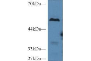 Western Blot; Sample: Mouse Liver lysate; Primary Ab: 2µg/ml Rabbit Anti-Mouse TAFI Antibody Second Ab: 0. (CPB2 Antikörper  (AA 113-422))