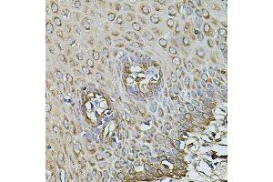 Immunohistochemistry of paraffin-embedded human esophagus using CPOX antibody. (CPOX Antikörper  (AA 111-454))