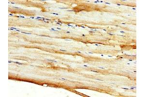IHC image of ABIN7149882 diluted at 1:500 and staining in paraffin-embedded human skeletal muscle tissue performed on a Leica BondTM system. (DKK2 Antikörper  (AA 34-259))
