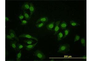 Immunofluorescence of monoclonal antibody to HNF4A on HeLa cell. (HNF4A Antikörper  (AA 324-423))