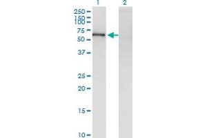 Western Blot analysis of ZNF192 expression in transfected 293T cell line by ZNF192 monoclonal antibody (M01), clone 1F2. (ZNF192 Antikörper  (AA 1-90))