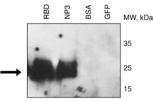 Binding of CR3022 to RBD and NP3 (fragment 3) of 2019nCoV proteins by Western blotting . (SARS-CoV-2 Antikörper)