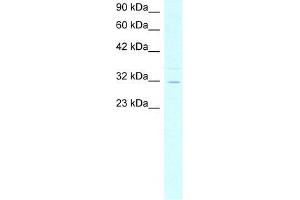 Human HepG2; WB Suggested Anti-ASGR2 Antibody Titration: 4. (Asialoglycoprotein Receptor 2 Antikörper  (N-Term))
