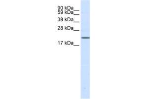 Western Blotting (WB) image for anti-Sodium Channel, Voltage-Gated, Type III, beta Subunit (SCN3B) antibody (ABIN2461577) (SCN3B Antikörper)