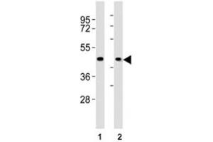 Western blot testing of CCR1 antibody at 1:2000 dilution. (CCR1 Antikörper  (AA 13-44))
