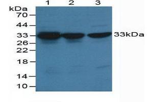 Western blot analysis of (1) Human HeLa cells, (2) Human Hepg2 Cells and (3) Human K-562 Cells. (CDK2 Antikörper  (AA 5-346))