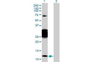 Western Blot analysis of CBY1 expression in transfected 293T cell line by CBY1 MaxPab polyclonal antibody.
