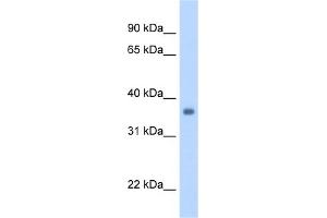WB Suggested Anti-SGCG Antibody Titration:  1.