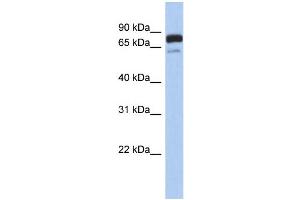 WB Suggested Anti-MTMR12 Antibody Titration: 0. (MTMR12 Antikörper  (Middle Region))