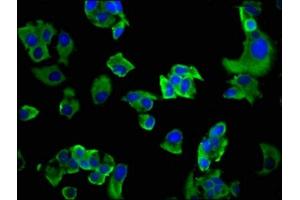 Immunofluorescence staining of MCF-7 cells with ABIN7163593 at 1:200, counter-stained with DAPI. (GP6 Antikörper  (AA 115-265))