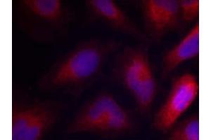 Immunofluorescence staining of methanol-fixed HeLa cells using MARCKS (Phospho-Ser162) Antibody (E011265, Red) (MARCKS Antikörper  (pSer162))