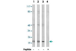 Western blot analysis of extracts from Jurkat cells (Lane 1), MCF-7 cells (Lane 2) and HepG2 cells (Lane 3 and lane 4), using MRPL32 polyclonal antibody . (MRPL32 Antikörper)