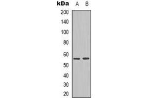 Western blot analysis of NPY5R expression in Jurkat (A), HepG2 (B) whole cell lysates. (NPY5R Antikörper)