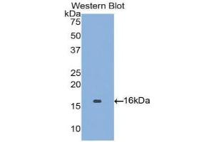 Western blot analysis of the recombinant protein. (Angiopoietin 2 Antikörper  (AA 1-123))