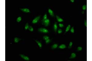 Immunofluorescence staining of Hela cells with ABIN7155794 at 1:133, counter-stained with DAPI. (MKX Antikörper  (AA 157-305))