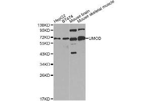 Western blot analysis of extracts of various cell lines, using UMOD Antibody. (Uromodulin Antikörper)
