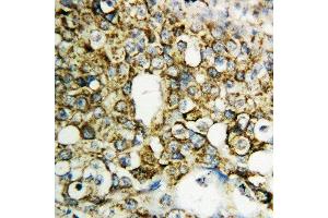 Immunohistochemistry (IHC) image for anti-Tissue Factor Pathway Inhibitor 2 (TFPI2) (AA 170-186), (Middle Region) antibody (ABIN3043614)