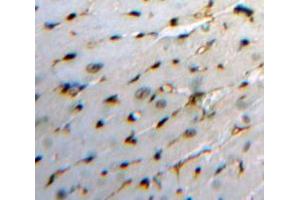Used in DAB staining on fromalin fixed paraffin-embedded Heart tissue (HBEGF Antikörper  (AA 21-160))