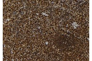 ABIN6263111 and ABIN6278722 at 1/100 staining Mouse spleen tissue by IHC-P. (MAP3K9 Antikörper  (C-Term))