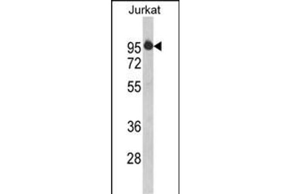 HTATSF1 Antikörper  (N-Term)