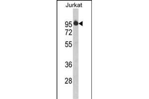 Western blot analysis of HTATSF1 Antibody (N-term) (ABIN390597 and ABIN2840915) in Jurkat cell line lysates (35 μg/lane). (HTATSF1 Antikörper  (N-Term))
