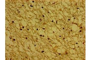 Immunohistochemistry of paraffin-embedded human brain tissue using ABIN7171138 at dilution of 1:100 (Synaptoporin Antikörper  (AA 199-265))