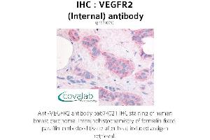 Image no. 1 for anti-VEGF Receptor 2 (VEGFR2) (Internal Region) antibody (ABIN1740694) (VEGFR2/CD309 Antikörper  (Internal Region))