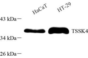 Western blot analysis of TSSK4 (ABIN7075865) at dilution of 1: 500 (TSSK4 Antikörper)