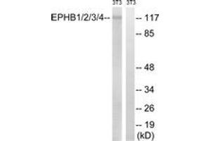 Western blot analysis of extracts from NIH-3T3 cells, treated with heat shock, using EPHB1/2/3/4 (Ab-600/602/614/596) Antibody. (EPH Receptor B1/2/3/4 (AA 566-615) Antikörper)
