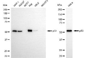 Western blotting analysis using p53 antibody (ABIN7800686).