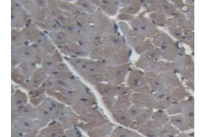 Immunohistochemistry (IHC) image for anti-Fatty Acid Binding Protein 3, Muscle and Heart (FABP3) (AA 2-133) antibody (ABIN7433318)
