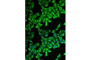 Immunofluorescence analysis of MCF-7 cells using DAP antibody. (DAP Antikörper)