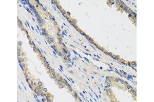 Immunohistochemistry of paraffin-embedded Human prostate using RAD51C Polyclonal Antibody at dilution of 1:100 (40x lens). (RAD51C Antikörper)