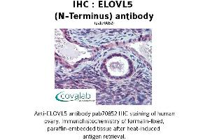 Image no. 2 for anti-ELOVL Fatty Acid Elongase 5 (ELOVL5) (N-Term) antibody (ABIN1733973) (ELOVL5 Antikörper  (N-Term))