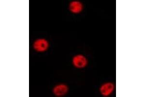 ABIN6277200 staining HepG2 by IF/ICC. (Histone 3 Antikörper  (H3K27me3))
