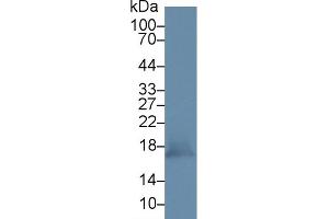 Detection of PRDX5 in Mouse Kidney lysate using Polyclonal Antibody to Peroxiredoxin 5 (PRDX5) (Peroxiredoxin 5 Antikörper  (AA 49-210))