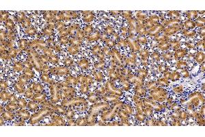Immunohistochemistry (IHC) image for anti-Caspase 1 (CASP1) (AA 317-404) antibody (ABIN7438055)