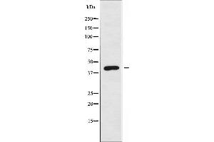 Western blot analysis of extracts from Jurkat cells using ARRDC3 antibody. (ARRDC3 Antikörper  (C-Term))