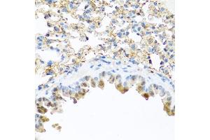 Immunohistochemistry of paraffin-embedded mouse lung using PI3 antibody (ABIN6132804, ABIN6145588, ABIN6145590 and ABIN6221092) at dilution of 1:100 (40x lens). (PI3 Antikörper  (AA 23-117))