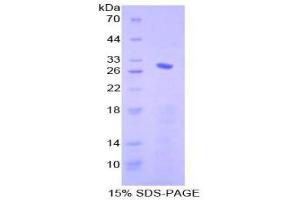 SDS-PAGE (SDS) image for SMAD Family Member 4 (SMAD4) (AA 323-552) protein (His tag) (ABIN2125956)
