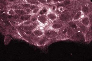 Immunofluorescence staining of HCT-8 cells. (PKC iota Antikörper  (AA 397-558))
